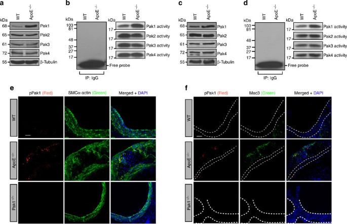 Figure 1: Pak1 expression and its activity increase in ApoE−/− mice.
