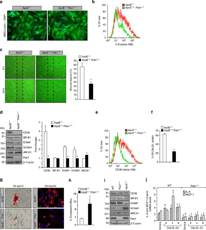 Figure 5: Pak1 regulates SMC migration and lesion formation.