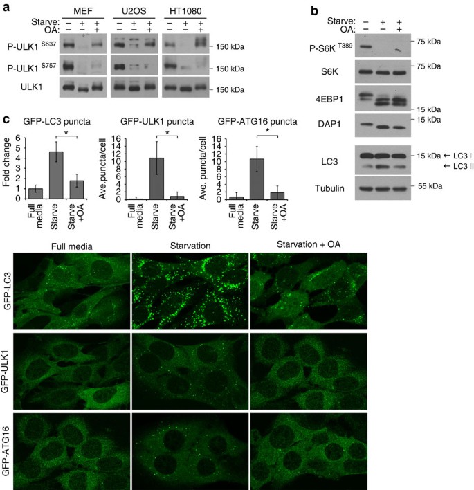 Figure 2: Okadaic acid inhibits autophagy.