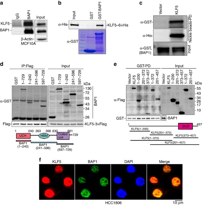 BAP1 promotes breast cancer cell proliferation and metastasis by  deubiquitinating KLF5 | Nature Communications