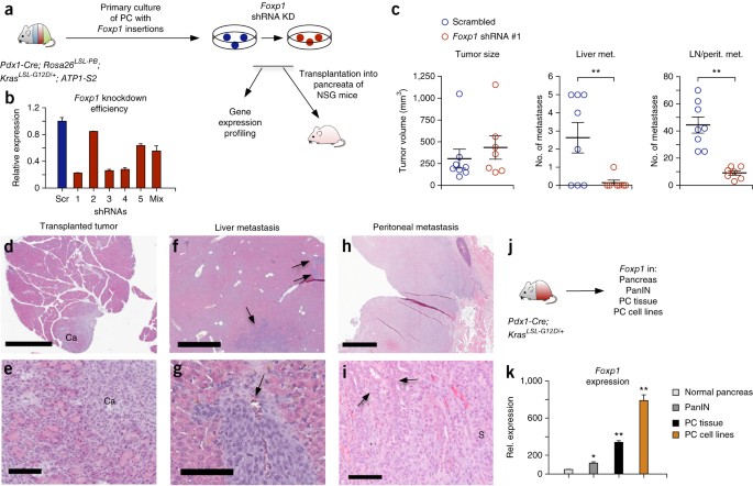 A Conditional Piggybac Transposition System For Genetic Screening In Mice Identifies Oncogenic Networks In Pancreatic Cancer Nature Genetics A Conditional Piggybac Transposition System For Genetic Screening In Mice Identifies Oncogenic Networks In Pancreatic Cancer Nature Genetics