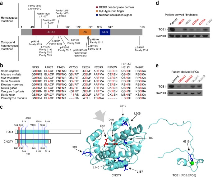 Biallelic Mutations In The 3 Exonuclease Toe1 Cause Pontocerebellar Hypoplasia And Uncover A Role In Snrna Processing Nature Genetics