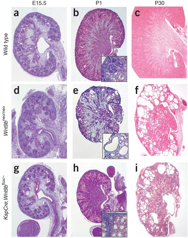 Wnt9b Signaling Regulates Planar Cell Polarity And Kidney Tubule Morphogenesis Nature Genetics