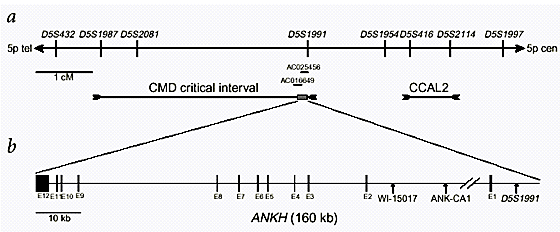 Heterozygous Mutations In Ankh The Human Ortholog Of The Mouse Progressive Ankylosis Gene Result In Craniometaphyseal Dysplasia Nature Genetics