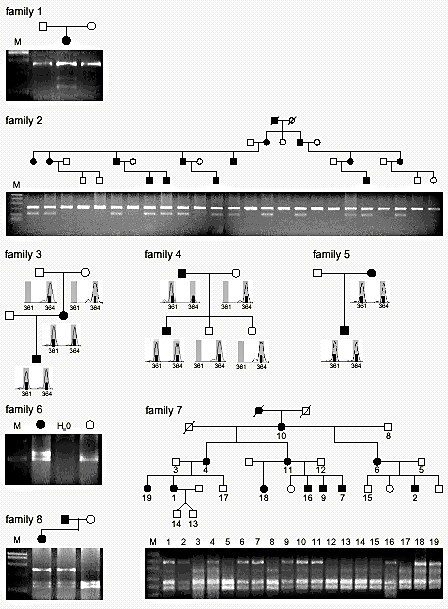 Heterozygous Mutations In Ankh The Human Ortholog Of The Mouse Progressive Ankylosis Gene Result In Craniometaphyseal Dysplasia Nature Genetics