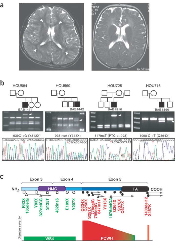 conveyed by allelic truncating mutations