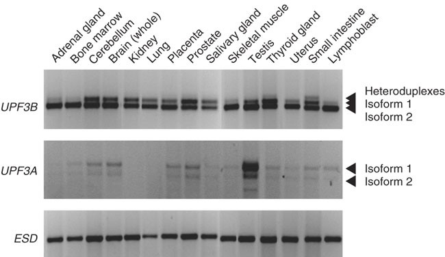 Mutations In Upf3b A Member Of The Nonsense Mediated Mrna Decay Complex Cause Syndromic And Nonsyndromic Mental Retardation Nature Genetics