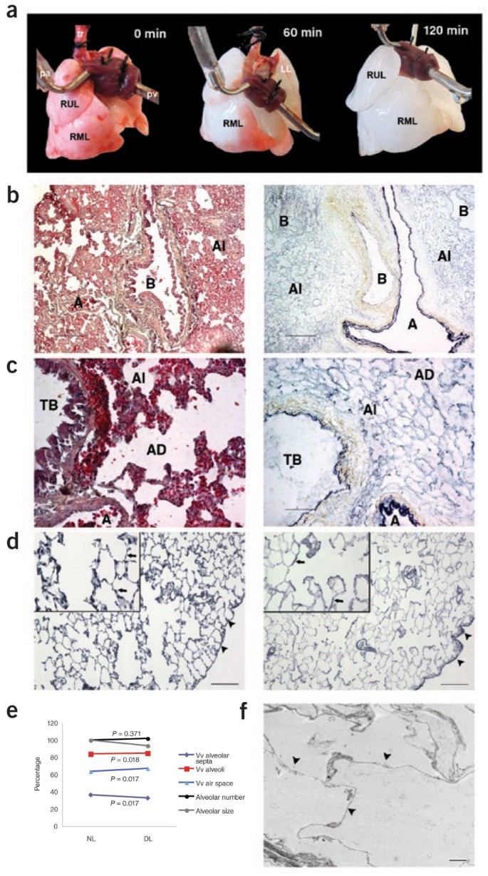 Regeneration and orthotopic transplantation of a bioartificial lung |  Nature Medicine