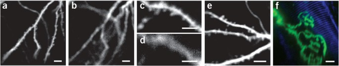 In Vivo Fluorescence Imaging With High Resolution Microlenses Nature Methods