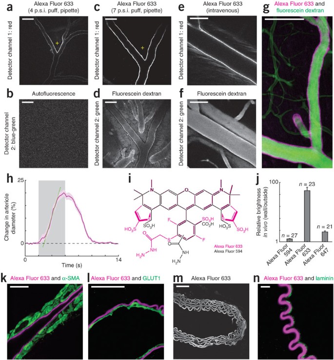 An artery-specific fluorescent dye for studying neurovascular coupling |  Nature Methods