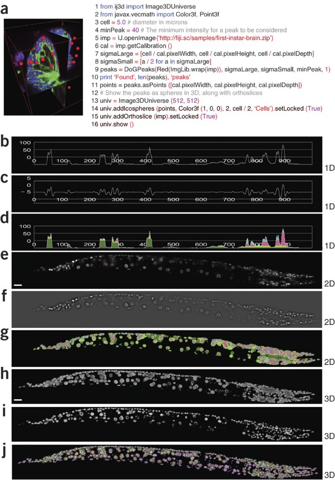 Fiji An Open Source Platform For Biological Image Analysis Nature Methods