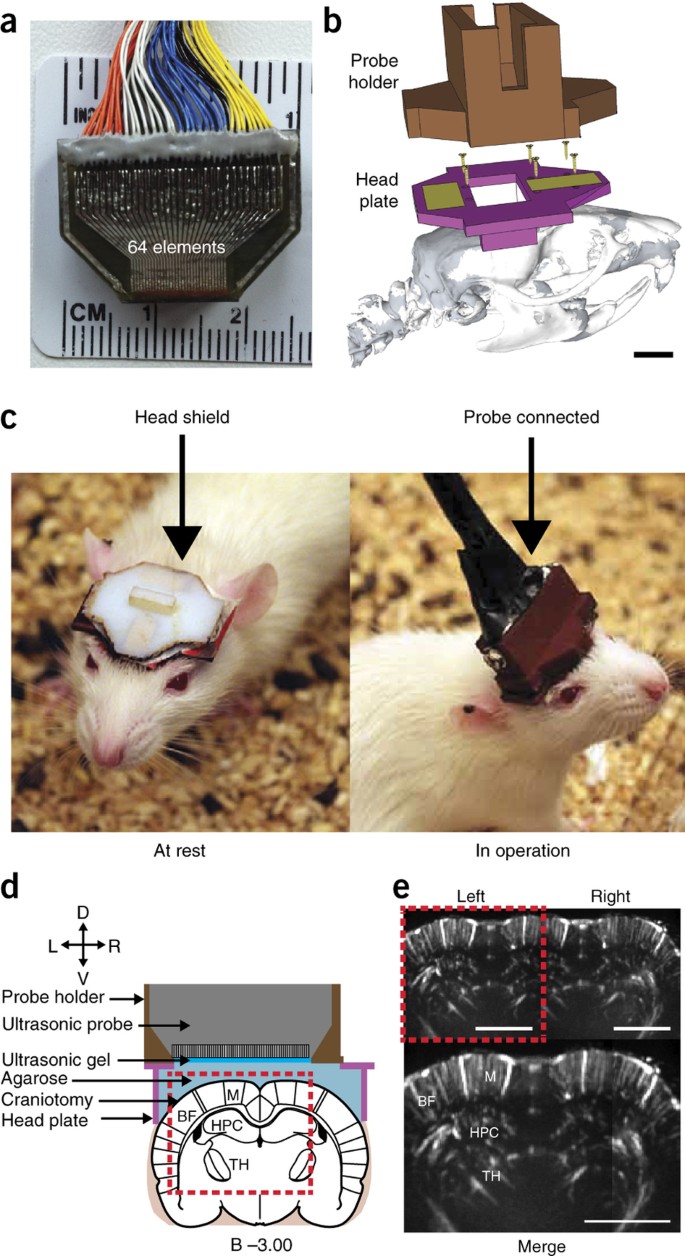 Real-time imaging of brain activity in freely moving rats using functional  ultrasound | Nature Methods