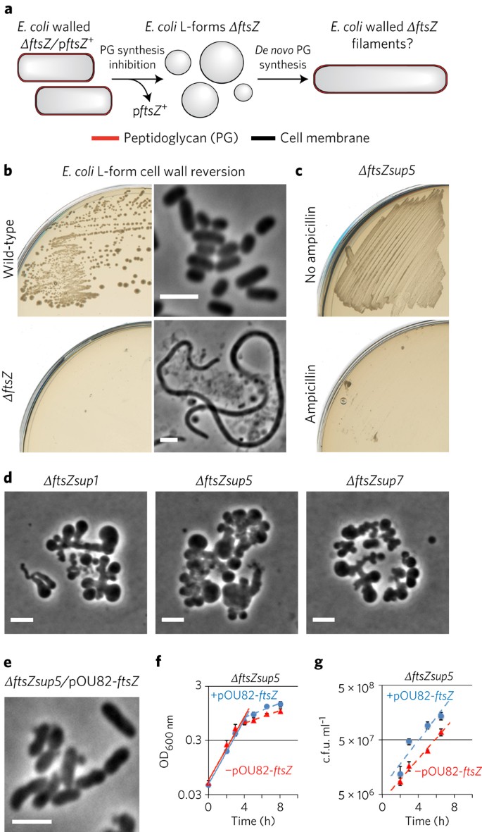 Wall Proficient E Coli Capable Of Sustained Growth In The Absence Of The Z Ring Division Machine Nature Microbiology Wall Proficient E Coli Capable Of Sustained Growth In The Absence Of The Z Ring Division Machine Nature Microbiology