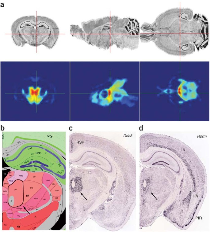 An Anatomic Gene Expression Atlas Of The Adult Mouse Brain Nature Neuroscience