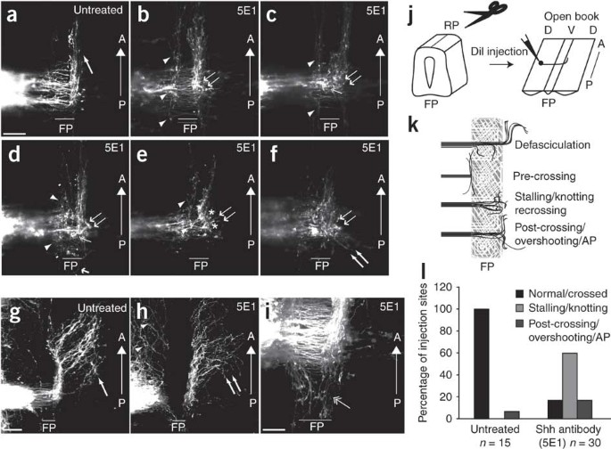 Sonic hedgehog induces response of commissural axons to Semaphorin  repulsion during midline crossing | Nature Neuroscience