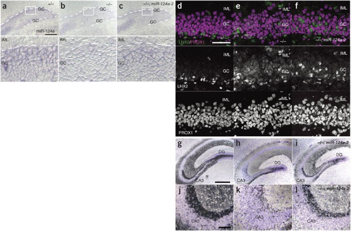 Mir 124a Is Required For Hippocampal Axogenesis And Retinal Cone Survival Through Lhx2 Suppression Nature Neuroscience