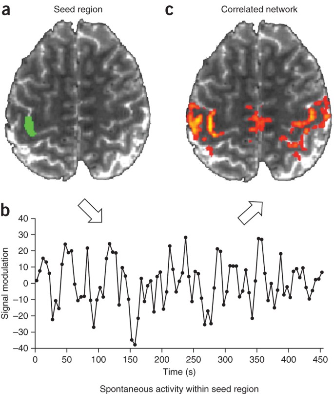Opportunities And Limitations Of Intrinsic Functional Connectivity Mri Nature Neuroscience