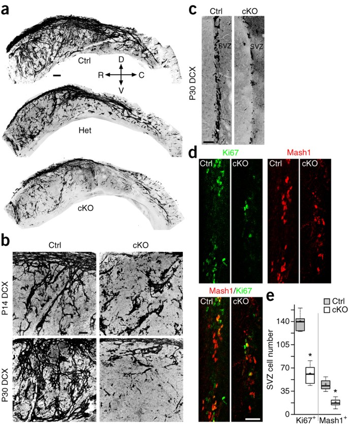 Identification Of Distinct Chat Neurons And Activity Dependent Control Of Postnatal Svz Neurogenesis Nature Neuroscience