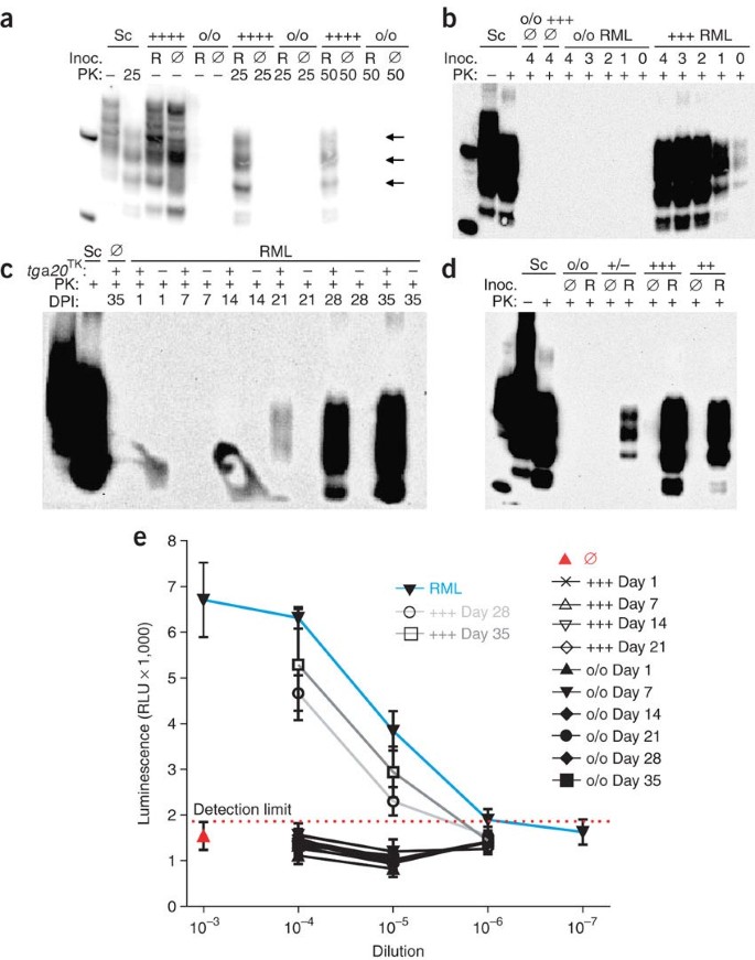 A Versatile Prion Replication Assay In Organotypic Brain Slices Nature Neuroscience