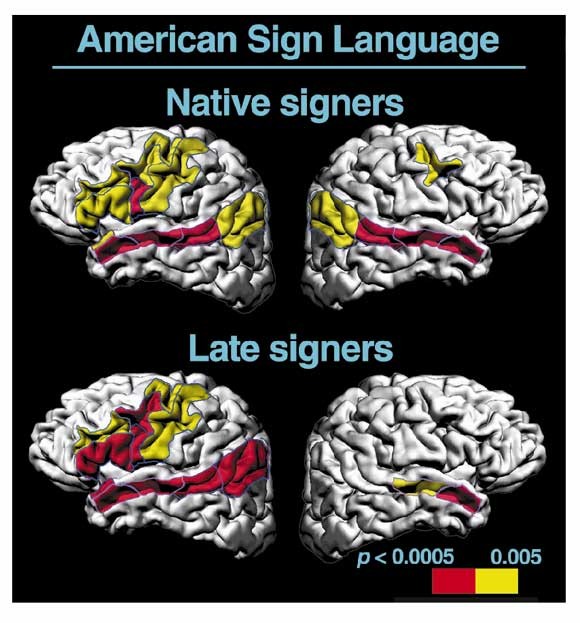 A critical period for right hemisphere recruitment in American 