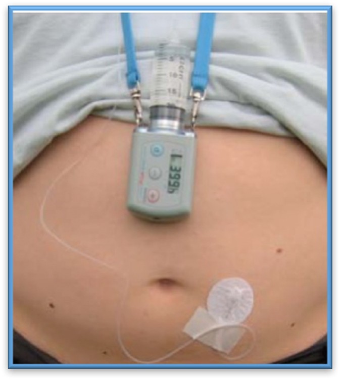 b12 injections for parkinson's Is vitamin good people with Parkinson's? Vitamin B-12 Injections In Hamilton,