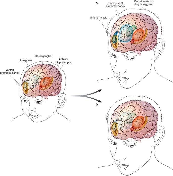 Behavioral Inhibition: Definition, Causes, Effects, and Strategies for Management