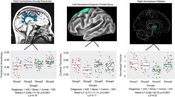 Brain-Behavior Participant Similarity Networks Among Youth and Emerging  Adults with Schizophrenia Spectrum, Autism Spectrum, or Bipolar Disorder  and Matched Controls | Neuropsychopharmacology