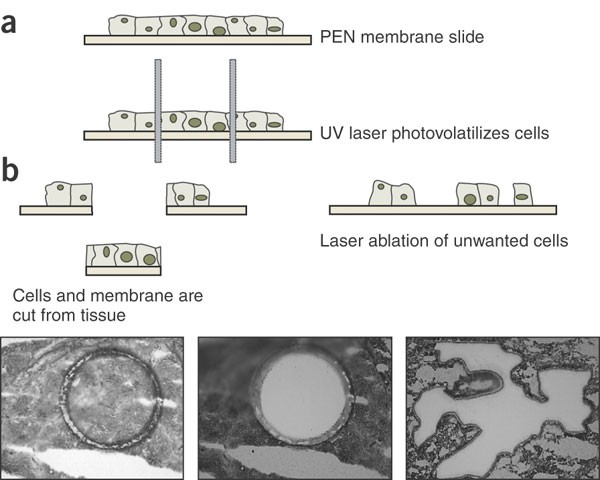 Laser-capture microdissection | Nature Protocols
