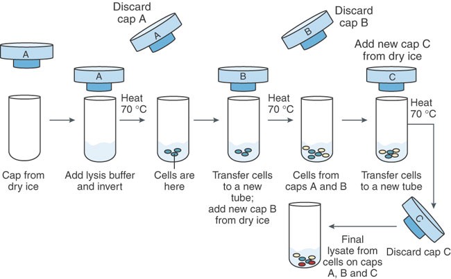 Laser Capture Microdissection Nature Protocols