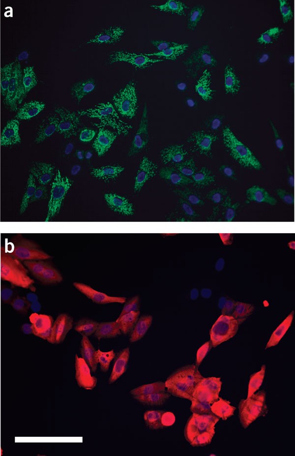 Measurement of superoxide dismutase, catalase and glutathione peroxidase in  cultured cells and tissue