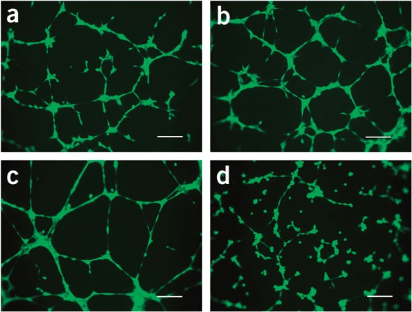 Branching out in vitro angiogenesis advancements RegMedNet