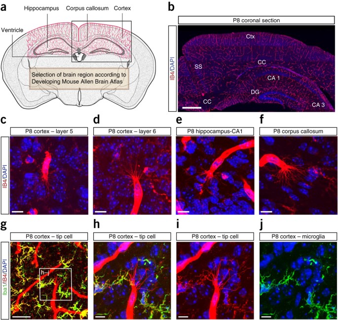 Quantitative assessment of angiogenesis, perfused blood vessels and  endothelial tip cells in the postnatal mouse brain | Nature Protocols