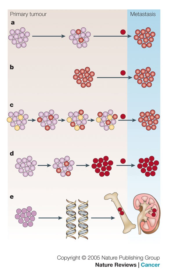 Breast cancer metastasis: markers and models Nature Reviews Cancer