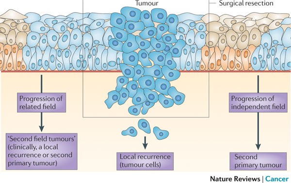 molecular biology head and neck cancer | Nature Cancer