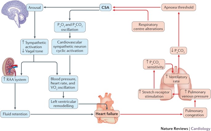 Heart Failure And Sleep Disorders Nature Reviews Cardiology