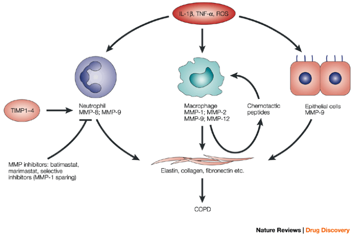 nebulized glutathione for emphysema Progress in the mechanism and targeted drug therapy for COPD main image 1