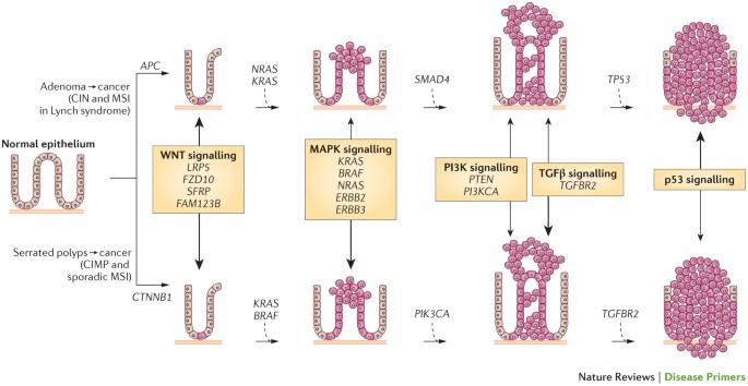 Ulcerative colitis  Nature Reviews Disease Primers