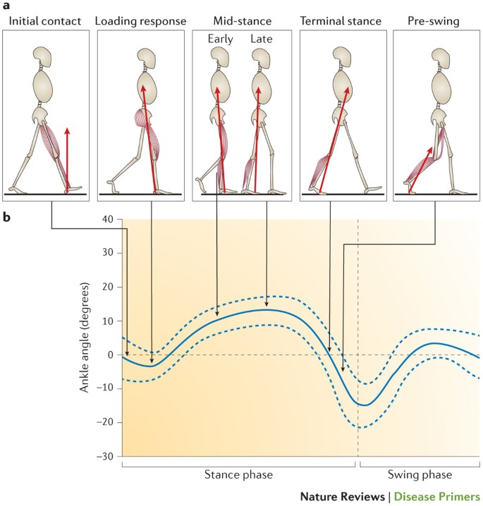 Cerebral Palsy Nature Reviews Disease Primers Cerebral Palsy Nature Reviews Disease Primers