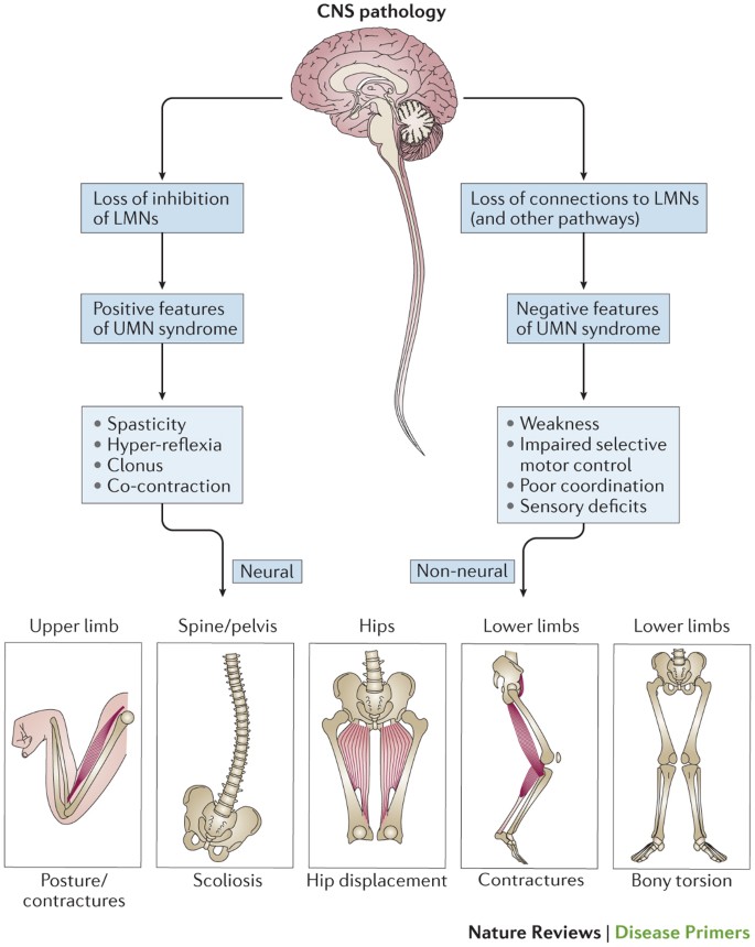 Cerebral Palsy Nature Reviews Disease Primers Cerebral Palsy Nature Reviews Disease Primers
