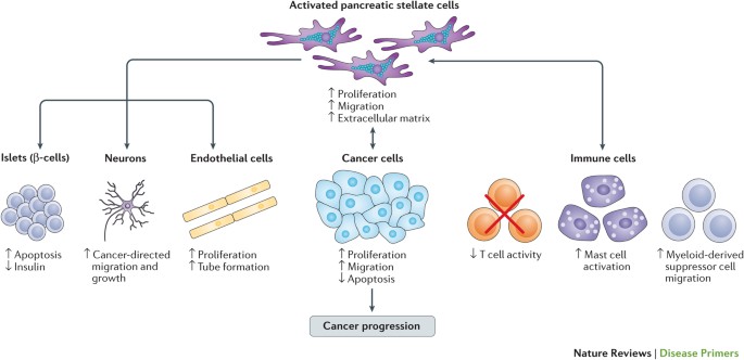 pancreatic cancer review)