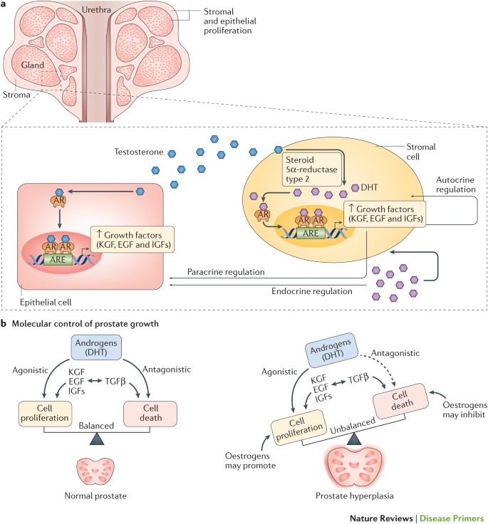 unilateral prostate enlargement