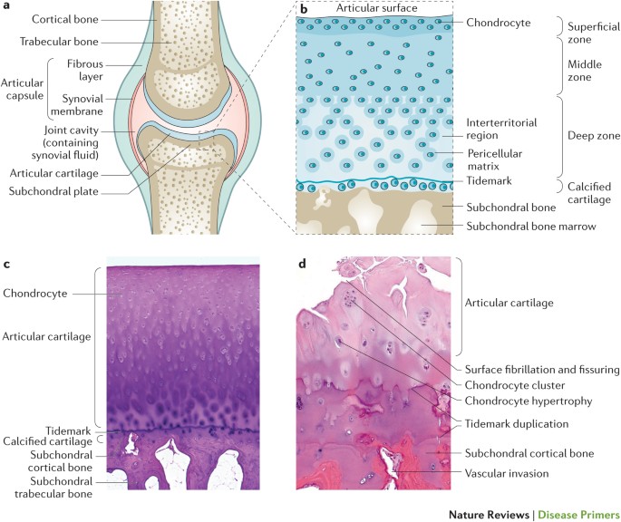 osteoarthritis and cartilage