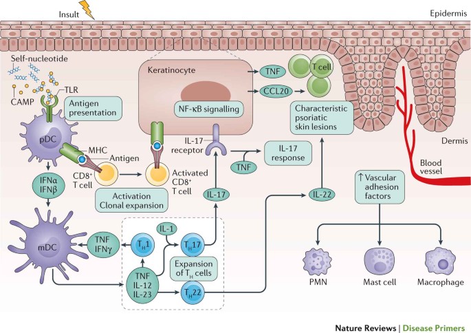 scalp psoriasis and immune system