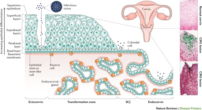 papillomavirus tünet)