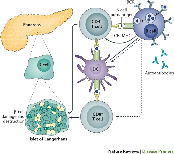 type 1 diabetes: etiology