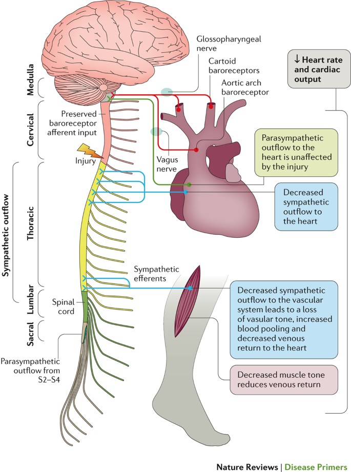 Traumatic spinal cord injury | Nature Reviews Disease Primers