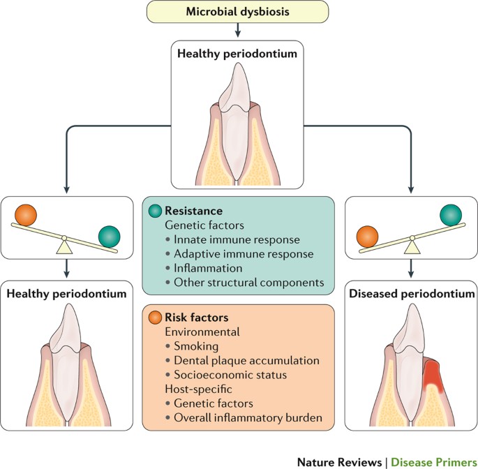 dysbiosis periodontal disease