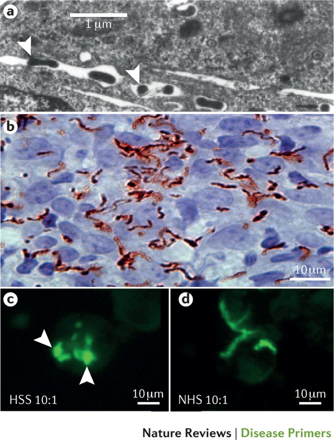 research paper about syphilis figure 4