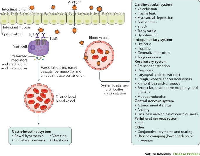 glutathione and ige food allergies Probiotics the Potential of Genetic Modification as a Possible Treatment for Allergy IgE producers in the gut