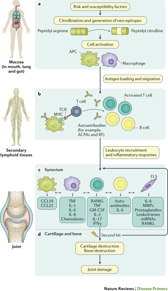 Pharmacogenetics and pharmacogenomics in rheumatology - Rheumatoid arthritis pathogenesis pdf